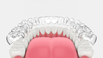 How Long Will It Take to Straighten My Teeth with Invisalign?