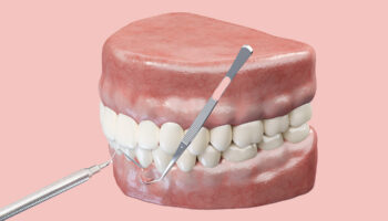 Is Gum Grafting Really Worth It? What You Should Know Before Deciding