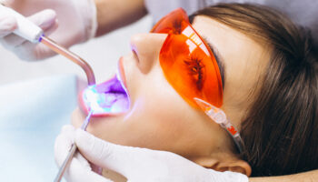 How to Help Sensitive Teeth after Whitening