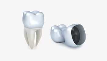 How Long Do Dental Crowns Last? Tips to Make Them Last Longer